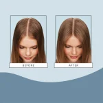 Ab-25127.webp