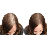 Ab-27356.webp