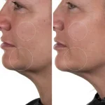 Ab-38017.webp